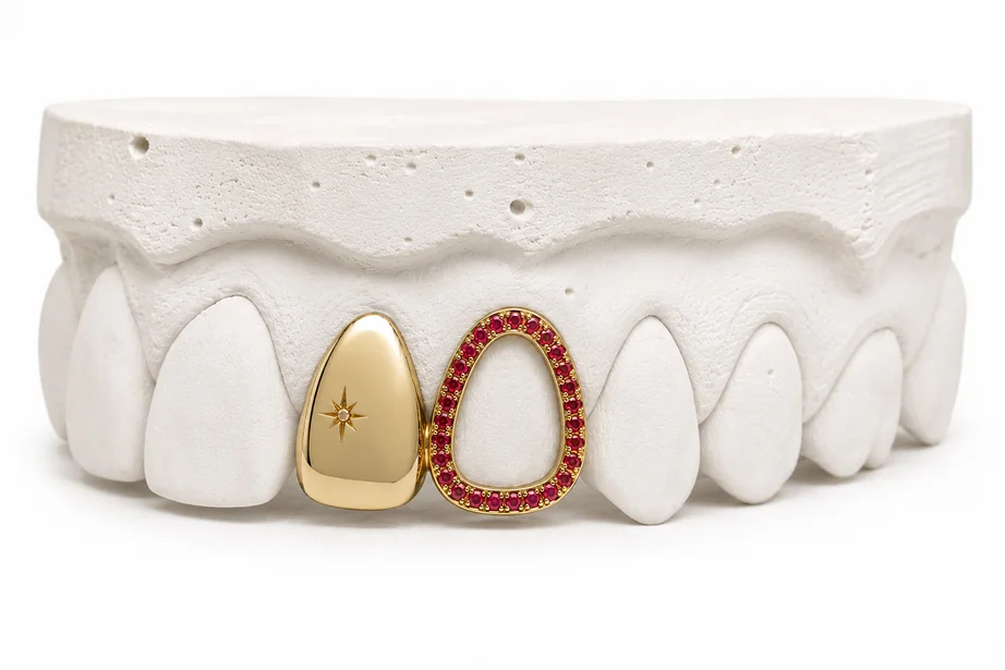 Due gioielli dentali in oro montati su un calco in gesso