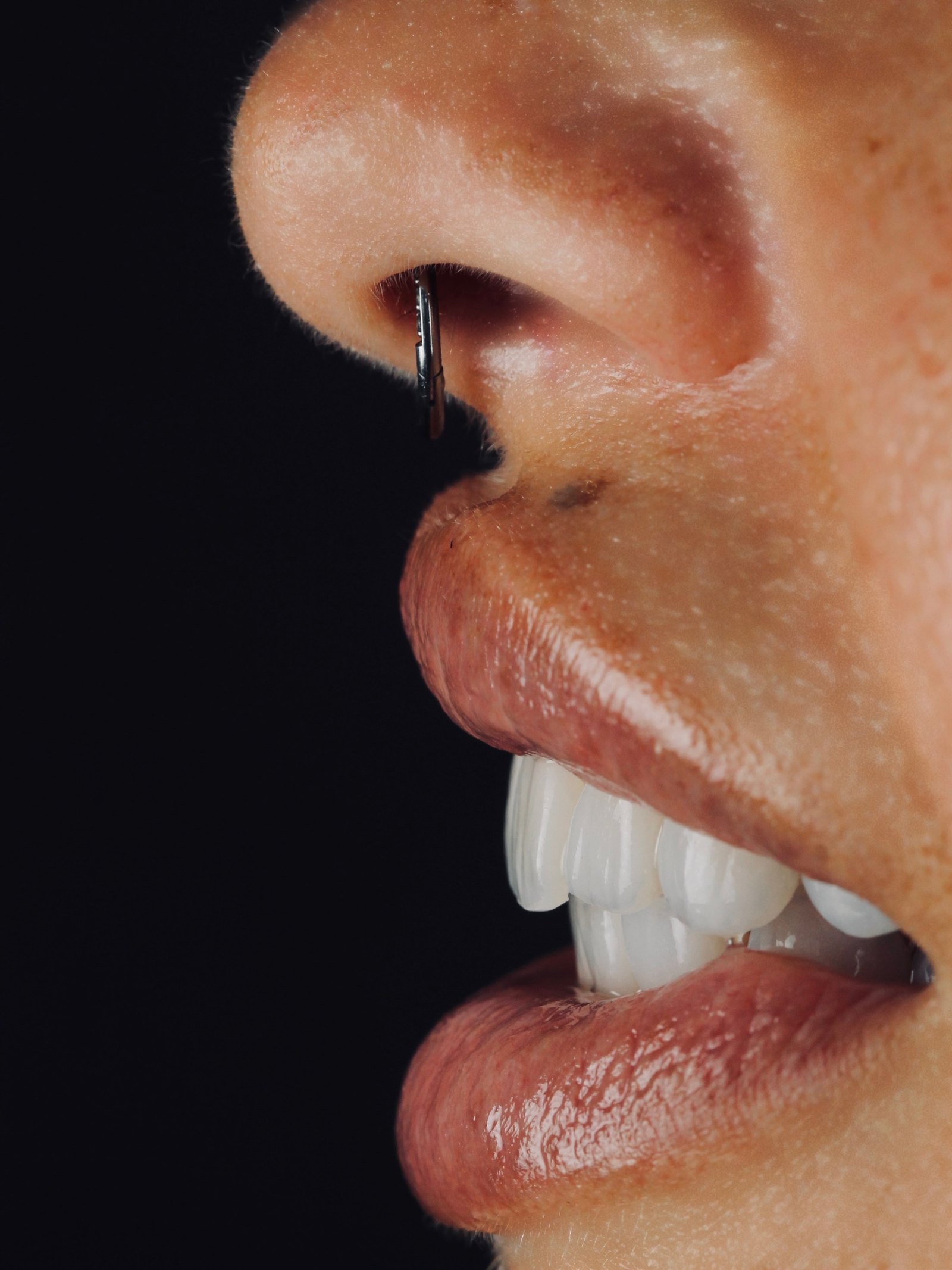 Sorriso di profilo: il bordo sottile e trasparente della ceramica